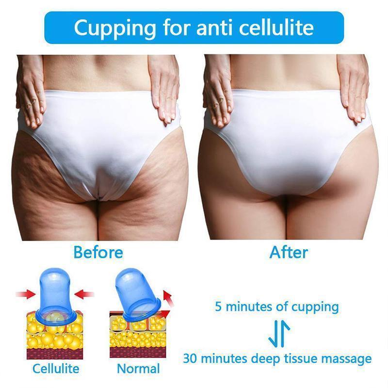 Becoolest™ Massage Slim Cup