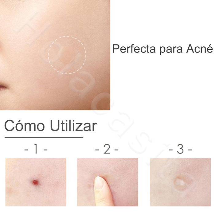 Parche para Acné Pegatinas de Espinillas, 30 piezas